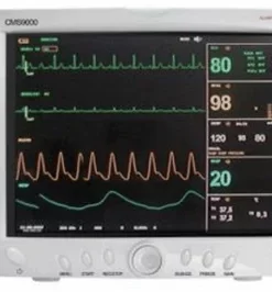 wireless electronic fetal monitoring