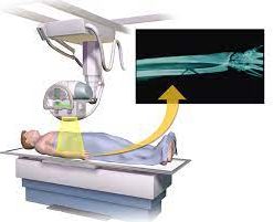 emax crown xray