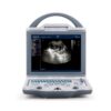 Rechargeable Human Ultrasound Scanner -Kx5600