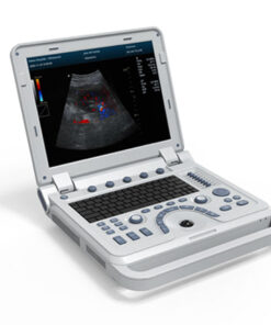 CMS600P2Plus B Ultrasound – Portable with Abdomen Convex Probe